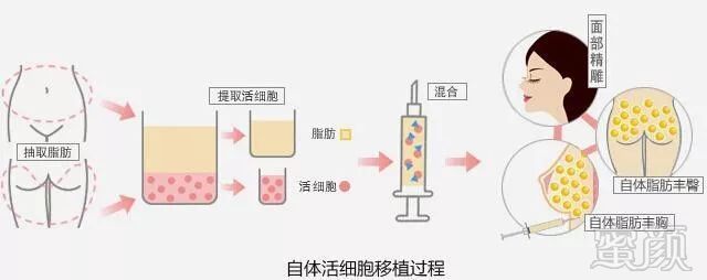 https://img.miyanlife.com/mnt/timg/190917/15134555Y-1.jpg