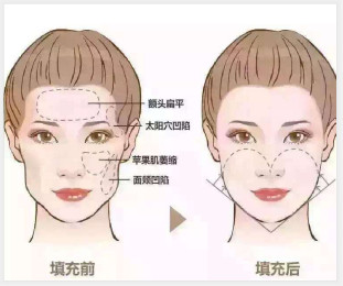 https://img.miyanlife.com/mnt/timg/190917/1513492329-9.jpg
