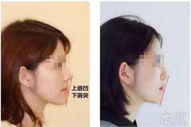 https://img.miyanlife.com/mnt/timg/190917/154ULc5-4.jpg