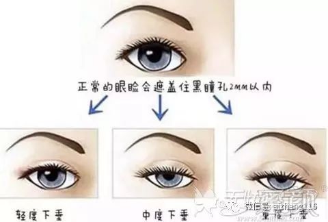 https://img.miyanlife.com/mnt/timg/190918/16091541N-1.jpg