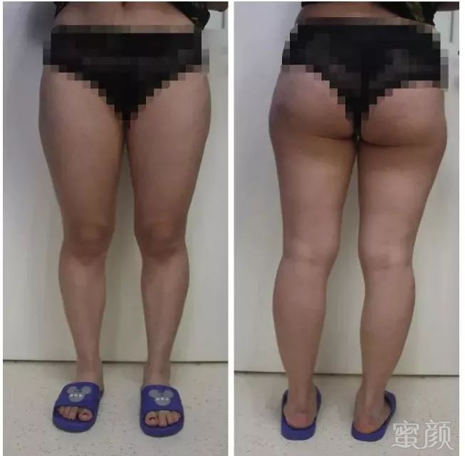 https://img.miyanlife.com/mnt/timg/190918/160U21M4-1.jpg