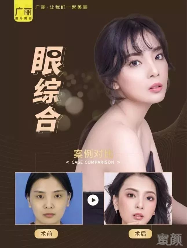 https://img.miyanlife.com/mnt/timg/190919/1JU4M23-3.jpg