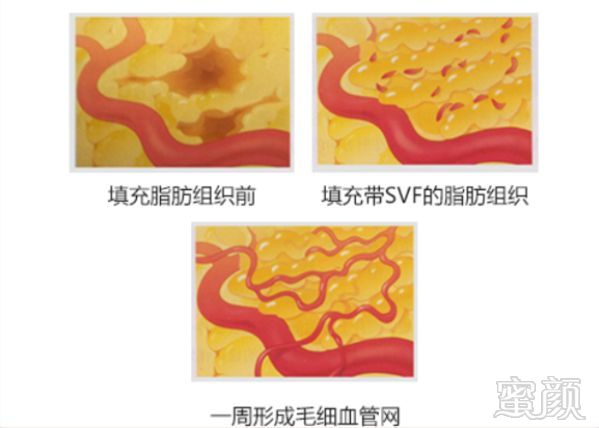 https://img.miyanlife.com/mnt/timg/190919/1KGRL3-4.jpg