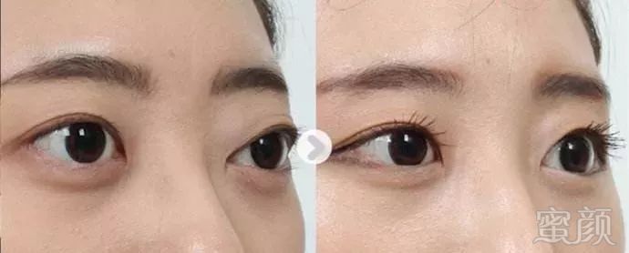 https://img.miyanlife.com/mnt/timg/190919/1P1115609-3.jpg