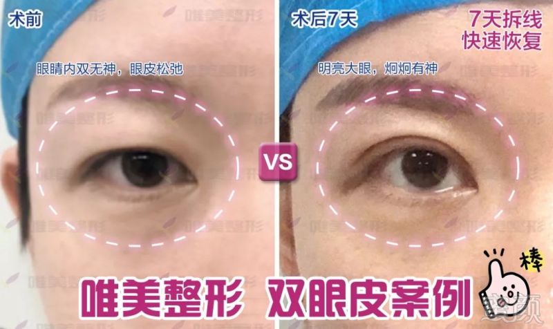 https://img.miyanlife.com/mnt/timg/190919/1P1136118-7.jpg