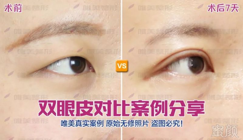 https://img.miyanlife.com/mnt/timg/190919/1P114J95-8.jpg