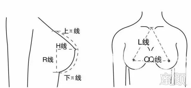 案例图片