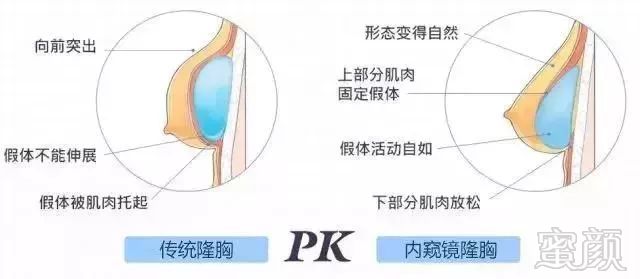 案例图片