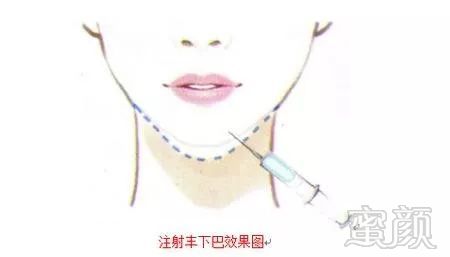 https://img.miyanlife.com/mnt/timg/190919/1Q155DL-10.jpg