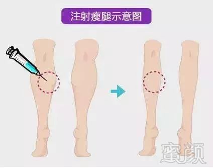 https://img.miyanlife.com/mnt/timg/190919/1Q40321C-4.jpg