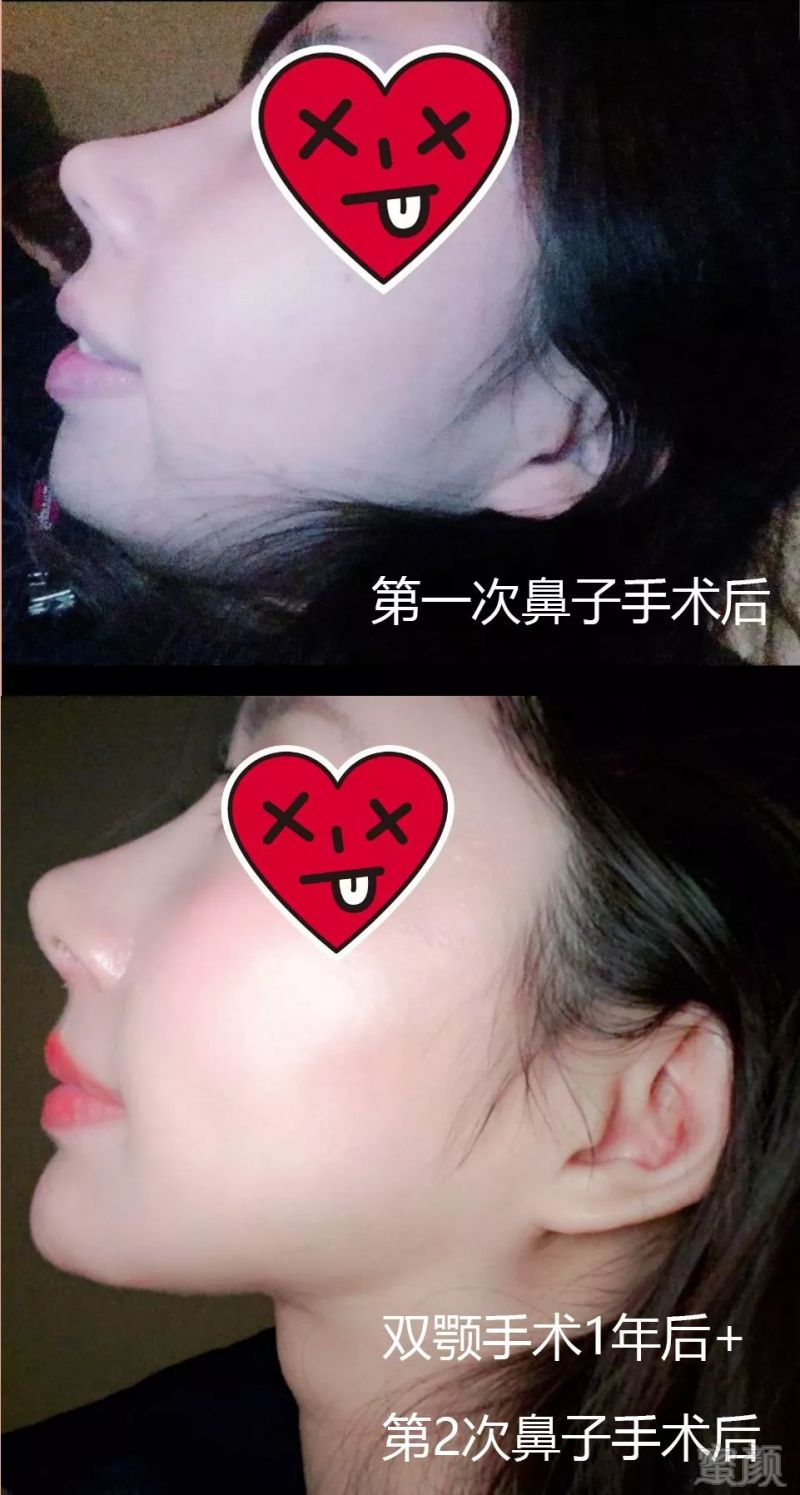 https://img.miyanlife.com/mnt/timg/190920/153P91525-11.jpg