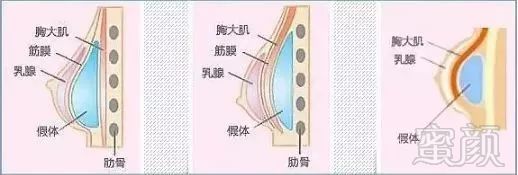 案例图片