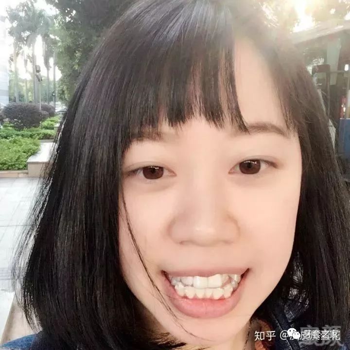 案例图片