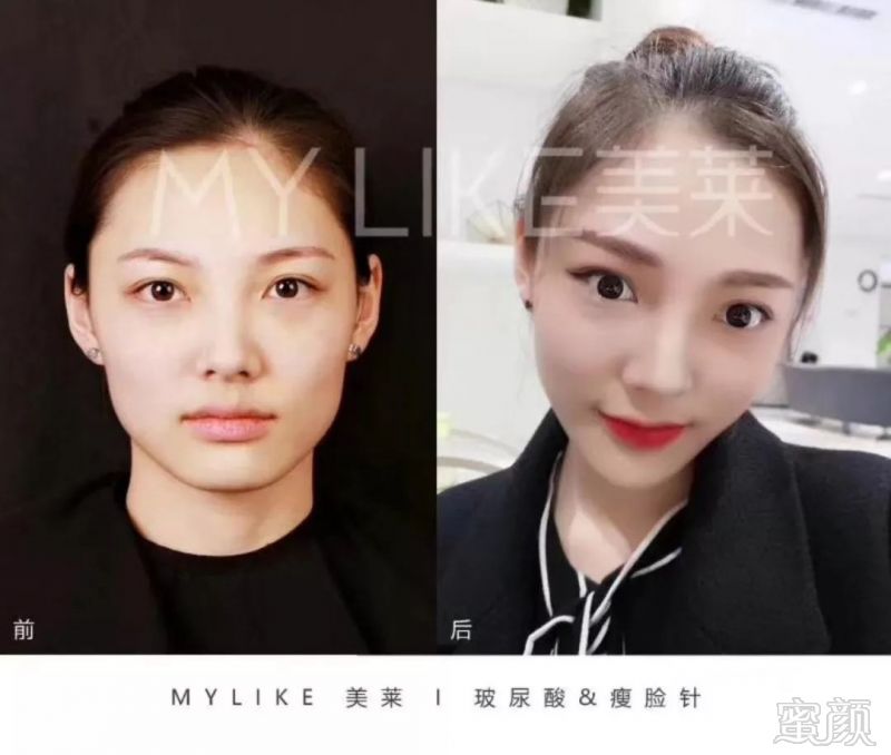 https://img.miyanlife.com/mnt/timg/190925/15000U917-13.jpg