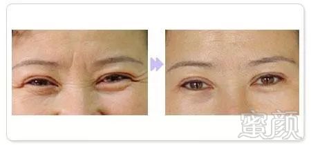 https://img.miyanlife.com/mnt/timg/190925/1500102234-15.jpg
