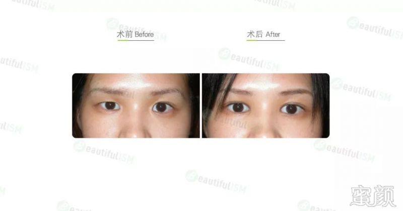 https://img.miyanlife.com/mnt/timg/190926/134U31159-2.jpg