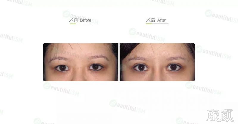 https://img.miyanlife.com/mnt/timg/190926/134U35624-1.jpg