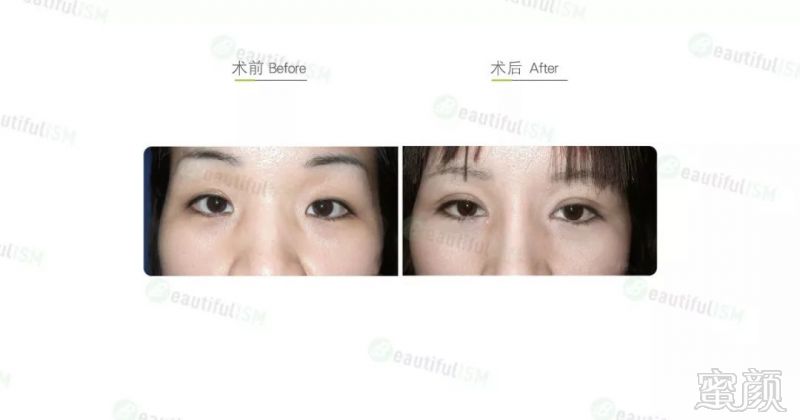 https://img.miyanlife.com/mnt/timg/190926/134U42412-3.jpg