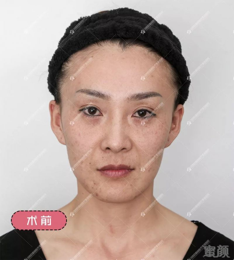 https://img.miyanlife.com/mnt/timg/190928/13153141L-1.jpg