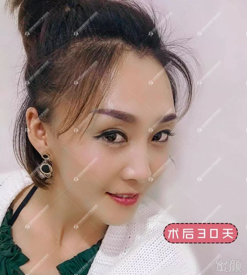 https://img.miyanlife.com/mnt/timg/190928/1315331291-2.jpg