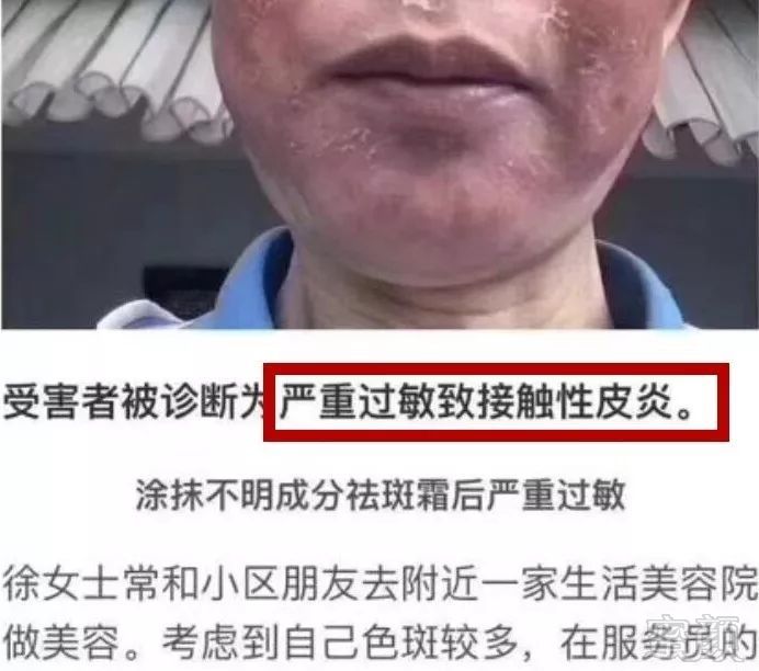 https://img.miyanlife.com/mnt/timg/190928/134040EG-2.jpg