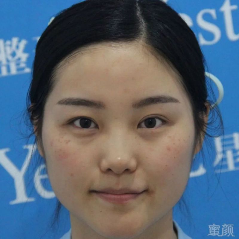https://img.miyanlife.com/mnt/timg/190928/13404L062-4.jpg