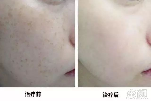 https://img.miyanlife.com/mnt/timg/190928/13404a337-6.jpg