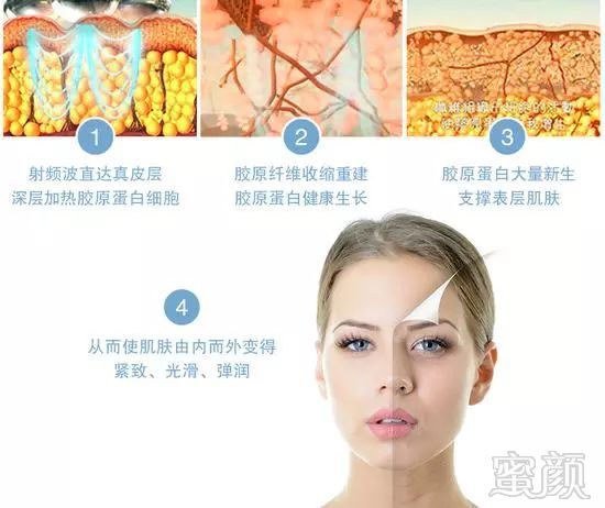 https://img.miyanlife.com/mnt/timg/191001/13015T4N-9.jpg
