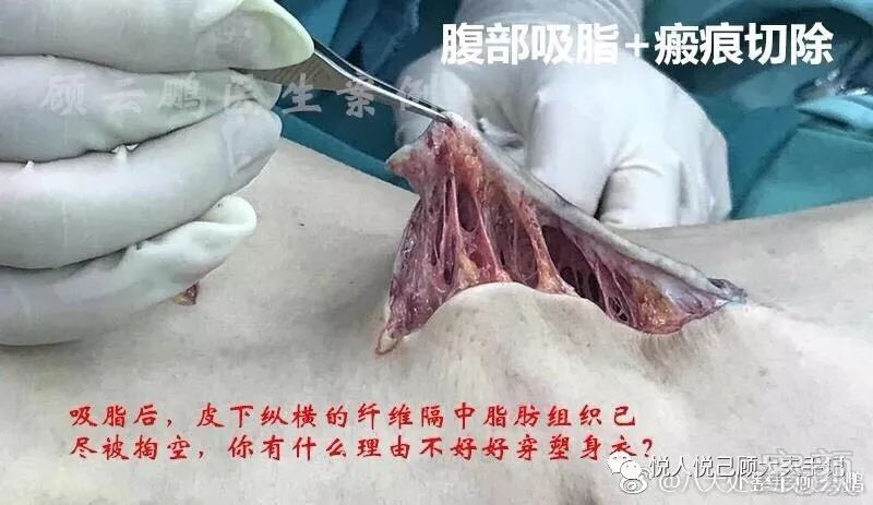 https://img.miyanlife.com/mnt/timg/191002/100U12000-2.jpg