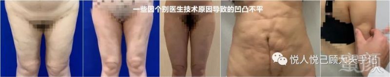 https://img.miyanlife.com/mnt/timg/191002/100U12452-1.jpg
