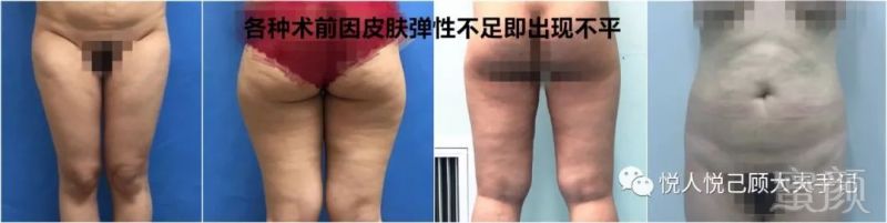 https://img.miyanlife.com/mnt/timg/191002/100U32X2-6.jpg