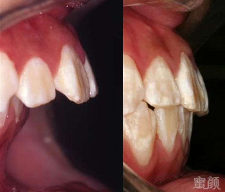 https://img.miyanlife.com/mnt/timg/191002/113ASY6-4.jpg