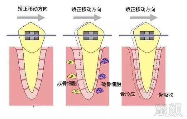 案例图片