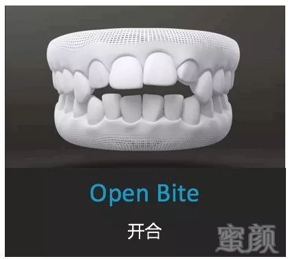 https://img.miyanlife.com/mnt/timg/191003/12335Q225-7.jpg