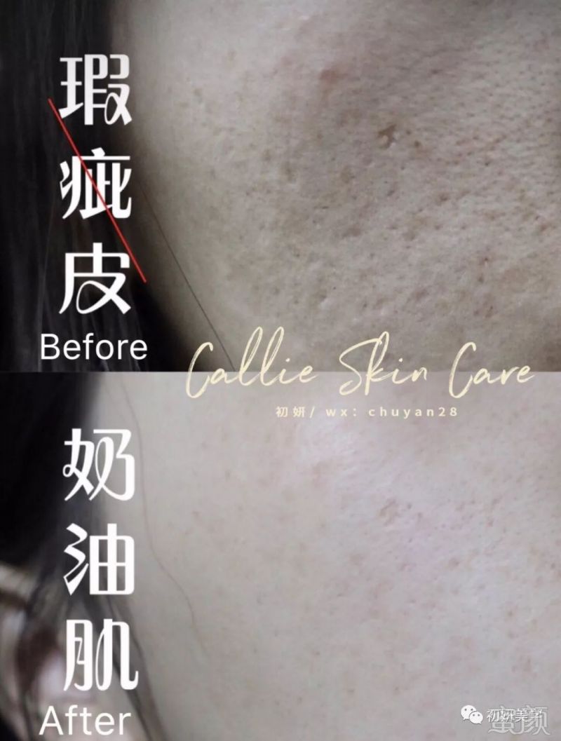 https://img.miyanlife.com/mnt/timg/191003/123T03V6-4.jpg