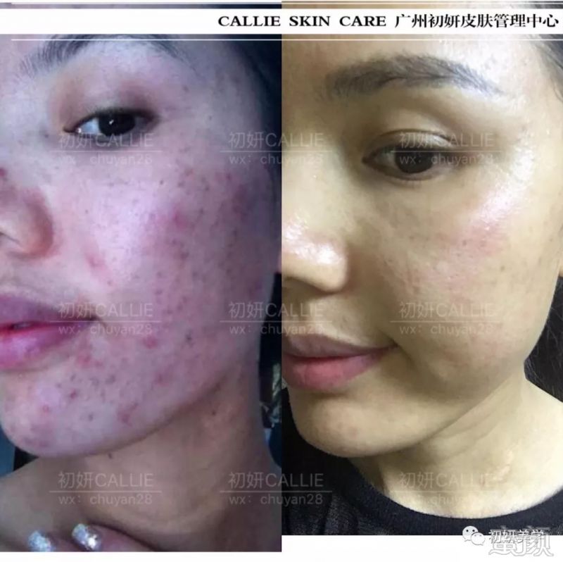 https://img.miyanlife.com/mnt/timg/191003/123T24437-7.jpg
