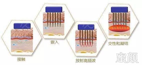 https://img.miyanlife.com/mnt/timg/191003/123T2N52-6.jpg