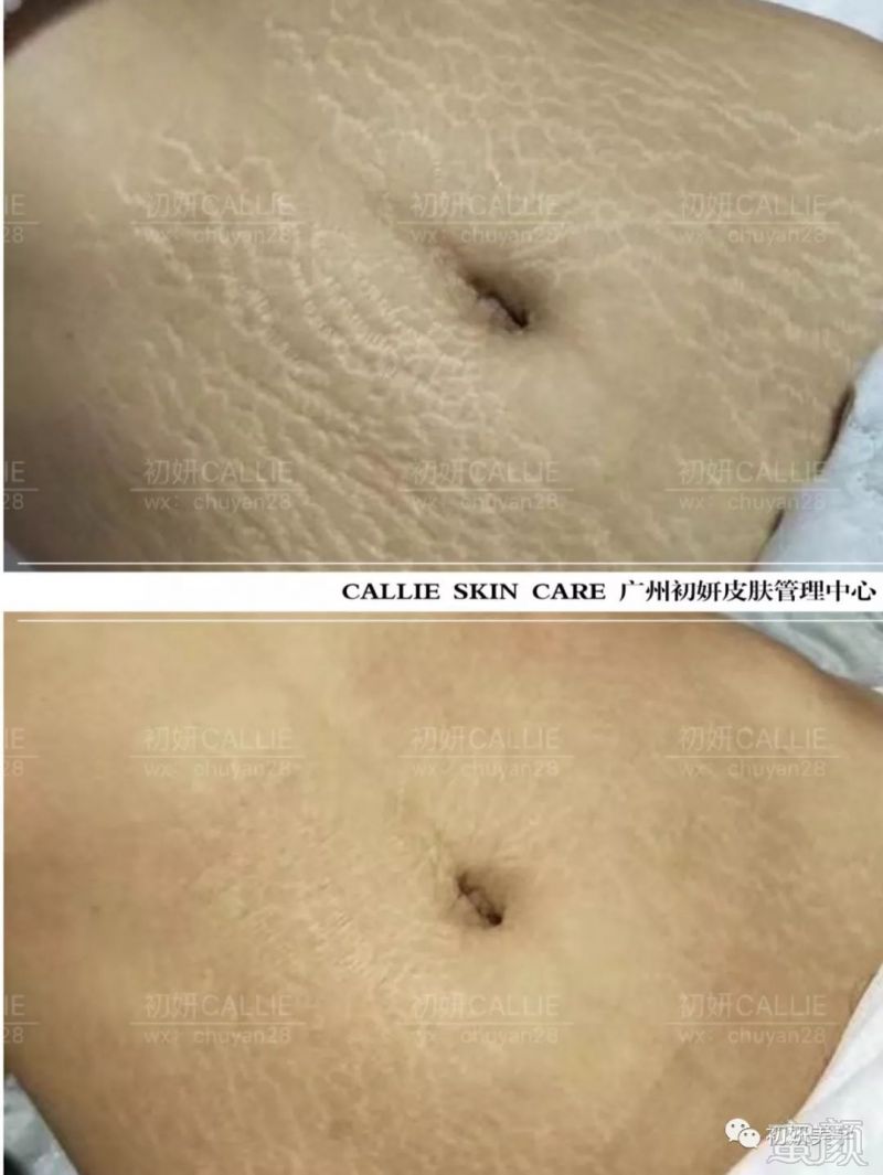 https://img.miyanlife.com/mnt/timg/191003/123T45A2-9.jpg