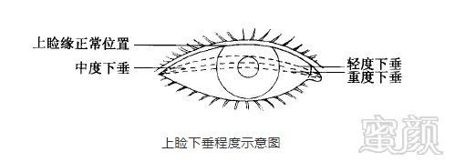 案例图片