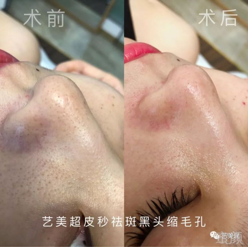 https://img.miyanlife.com/mnt/timg/191004/12102I051-0.jpg