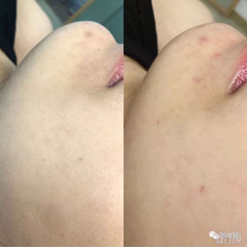https://img.miyanlife.com/mnt/timg/191004/12102T634-1.jpg