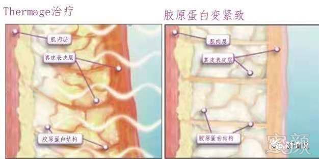 案例图片