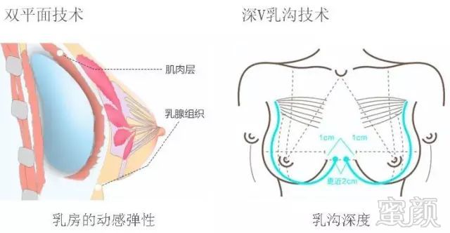 案例图片