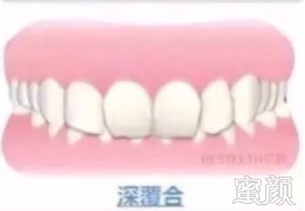 https://img.miyanlife.com/mnt/timg/191008/1431153145-6.jpg