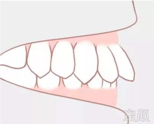 https://img.miyanlife.com/mnt/timg/191008/14311642O-7.jpg