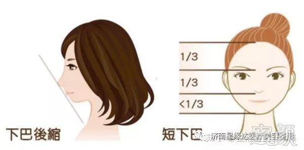 https://img.miyanlife.com/mnt/timg/191008/1450463451-3.jpg