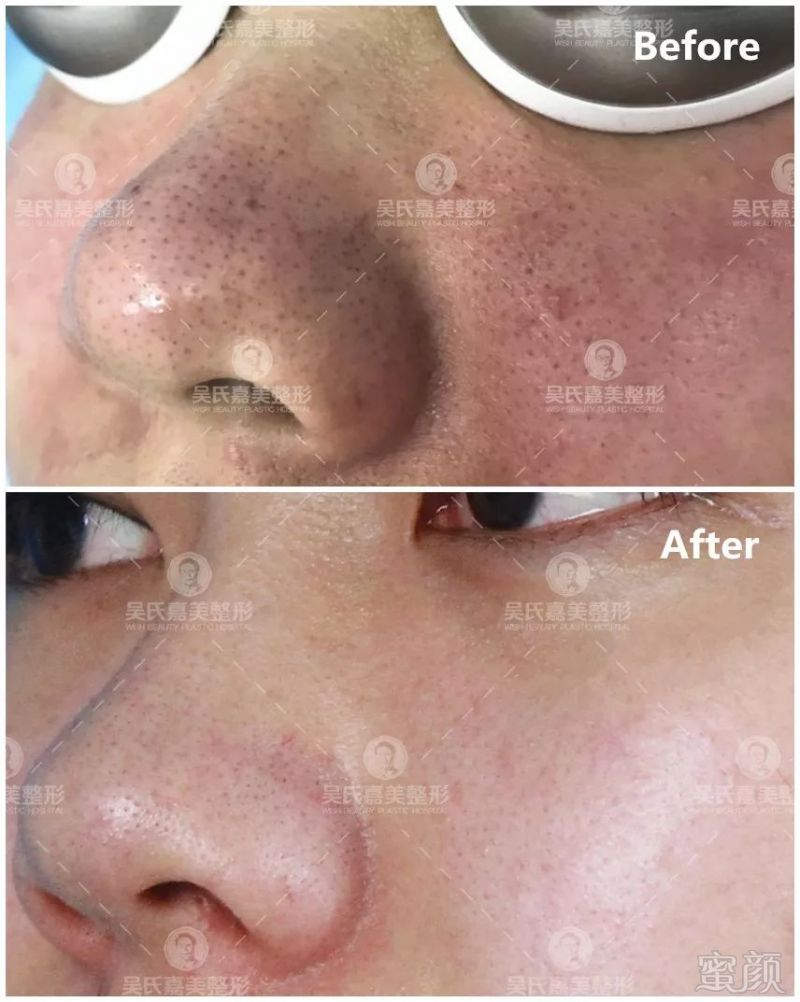 https://img.miyanlife.com/mnt/timg/191008/1454545119-8.jpg