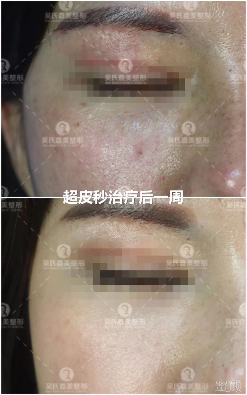 https://img.miyanlife.com/mnt/timg/191008/145505B07-14.jpg