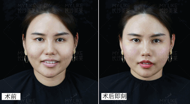 https://img.miyanlife.com/mnt/timg/191011/12261LS1-5.jpg