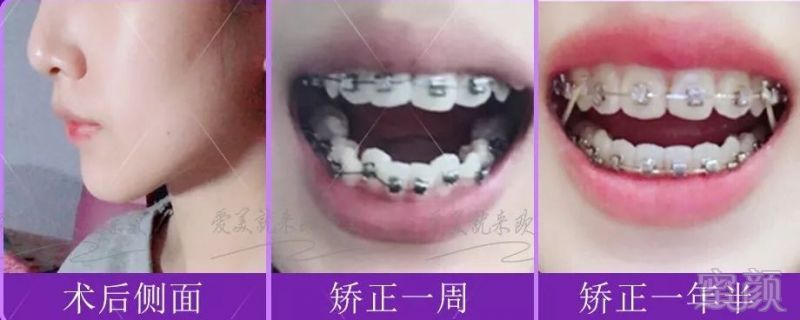 https://img.miyanlife.com/mnt/timg/191015/1032332E8-5.jpg